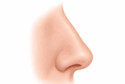 Rhinoplasty