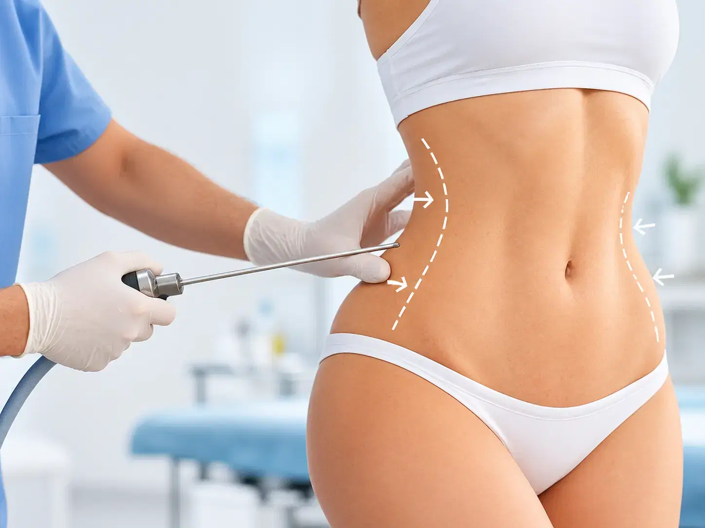 Liposuction in Turkey