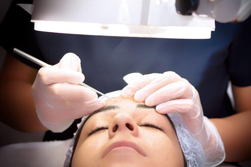 Oculoplasty