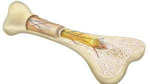 Bone Marrow Transplant at Jaypee, Noida, India