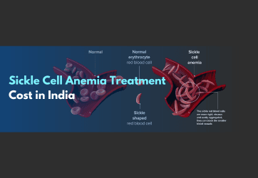 Sickle Cell Anemia treatment Cost in India