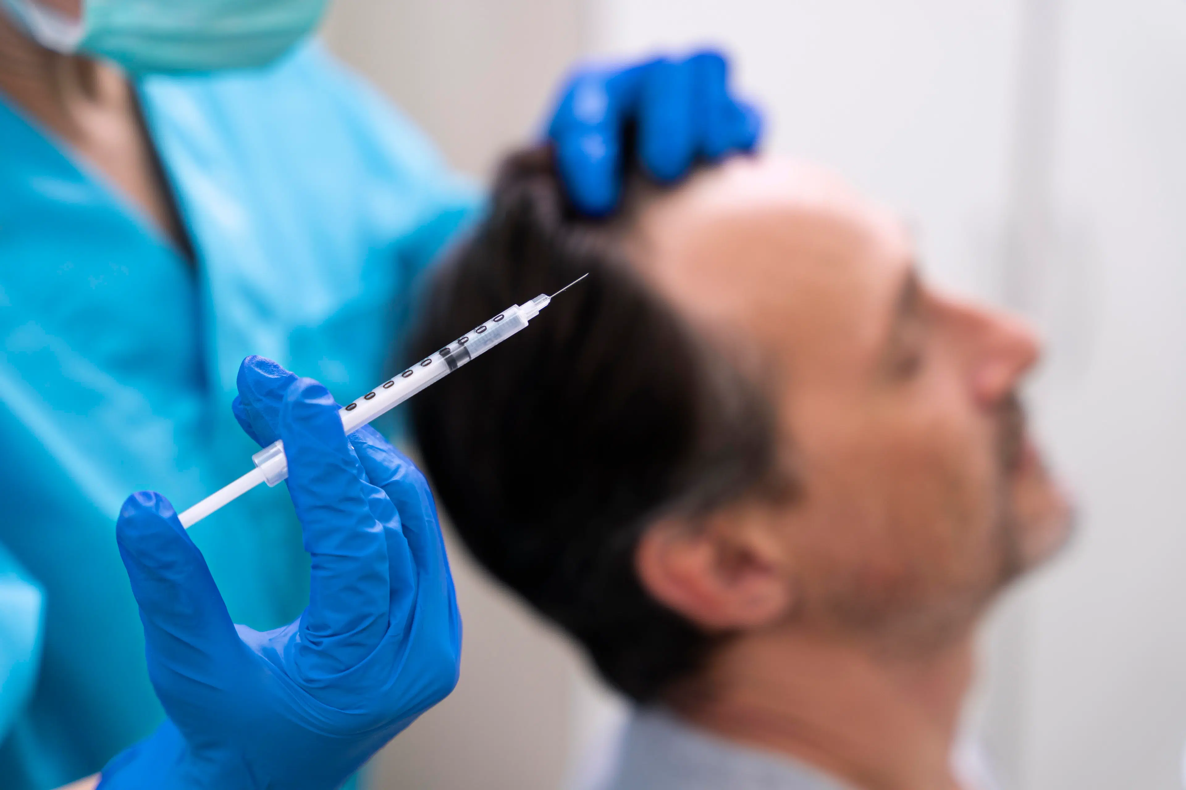 Haartransplantation in Bangkok, Thailand