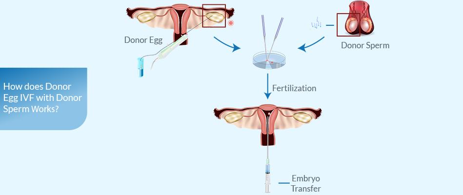 IVF-1 cycle own egg and sperm + IMSI including Injections