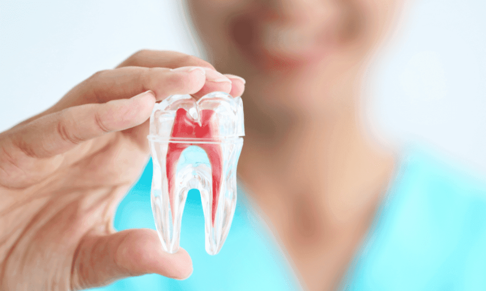 Root Canal Treatment