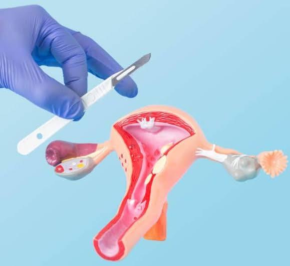 Vaginoplasty with Hymenoplasty at Saudi German Dubai