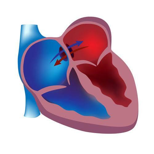 ASD / VSD Closure at Asian Hospital