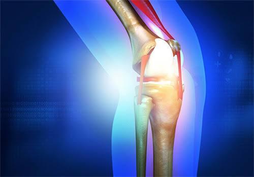 Bilateral Knee Replacement at Medical Park