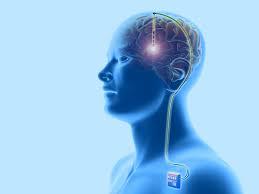 Deep Brain Stimutation Treatment at Medanta Hospital